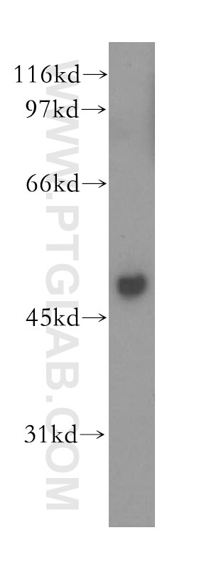 Western Blot (WB) analysis of human stomach tissue using MSY2 Polyclonal antibody (13538-1-AP)