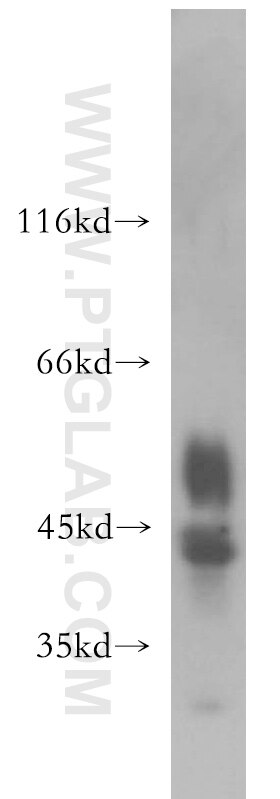 Western Blot (WB) analysis of human testis tissue using MSY2 Polyclonal antibody (13538-1-AP)