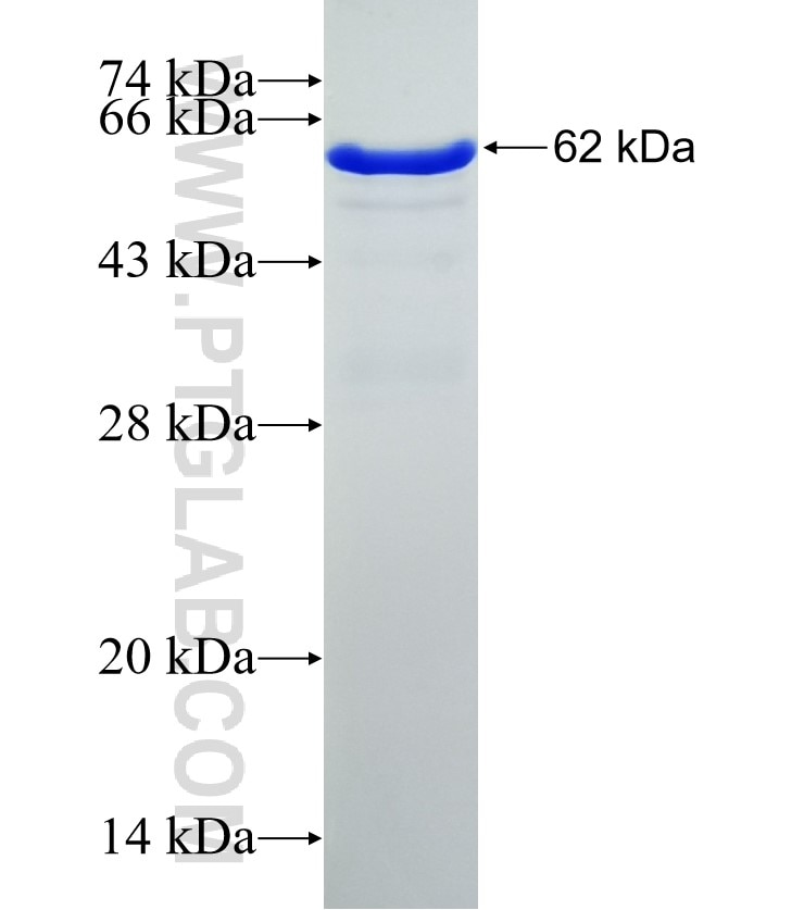 YBX2 fusion protein Ag4465 SDS-PAGE