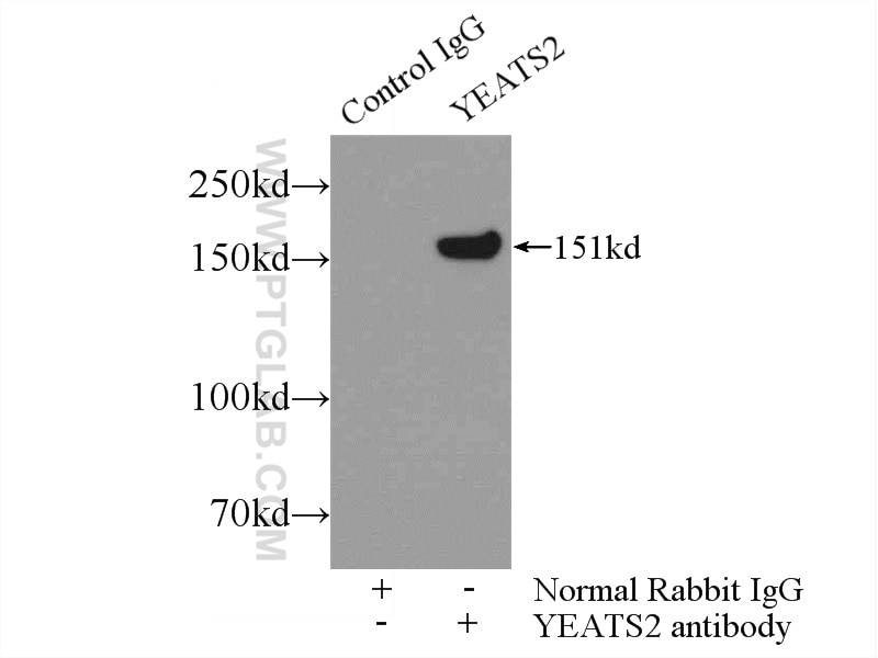 Immunoprecipitation (IP) experiment of Jurkat cells using YEATS2 Polyclonal antibody (24717-1-AP)