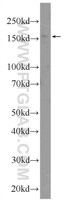 Western Blot (WB) analysis of Jurkat cells using YEATS2 Polyclonal antibody (24717-1-AP)