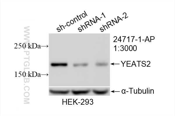 Western Blot (WB) analysis of HEK-293 cells using YEATS2 Polyclonal antibody (24717-1-AP)