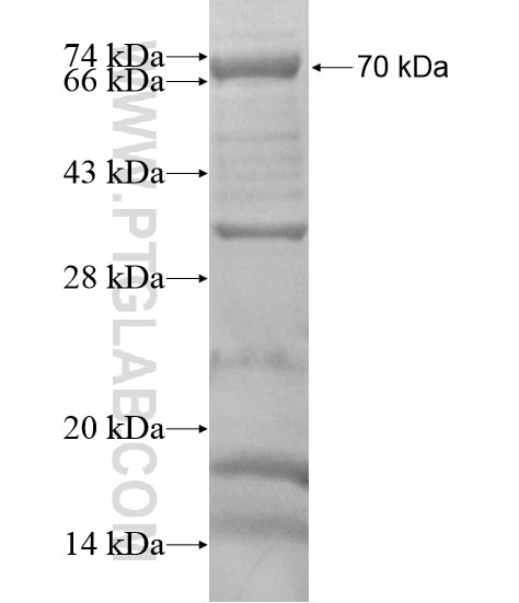 YEATS2 fusion protein Ag20134 SDS-PAGE