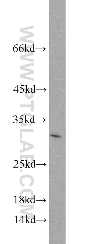 Western Blot (WB) analysis of human brain tissue using GAS41 Polyclonal antibody (11050-1-AP)