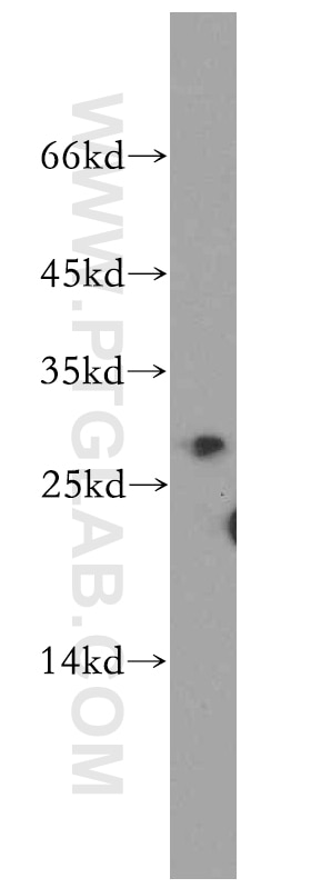 Western Blot (WB) analysis of A549 cells using GAS41 Polyclonal antibody (11050-1-AP)
