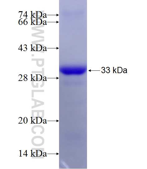 YEATS4 fusion protein Ag25539 SDS-PAGE