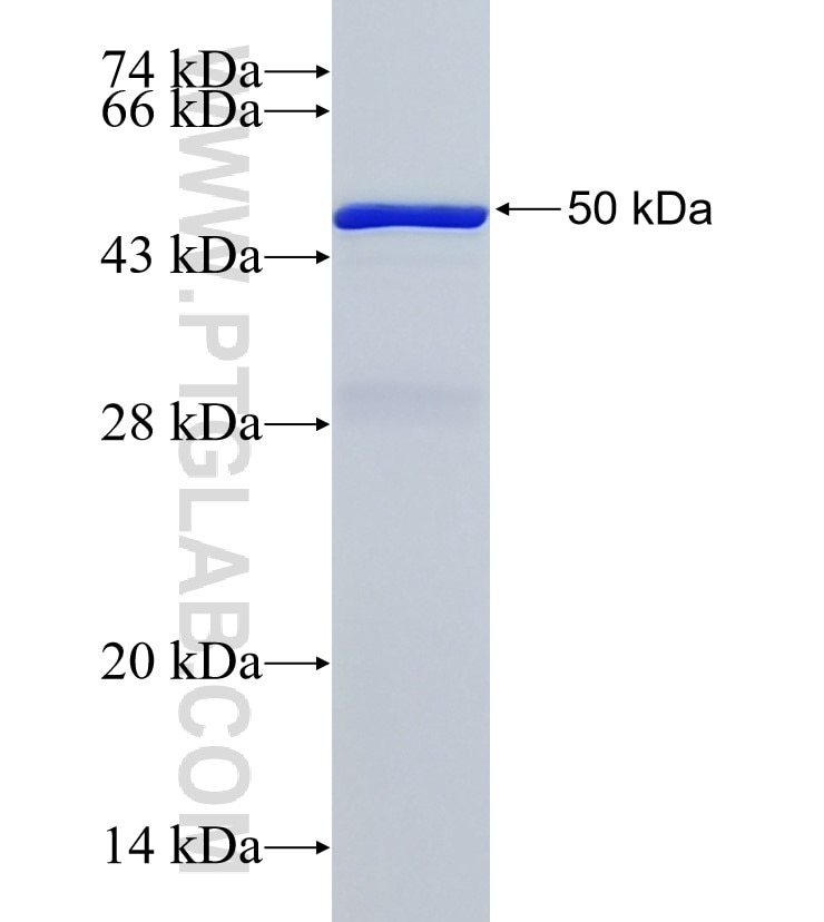 YEATS4 fusion protein Ag1524 SDS-PAGE