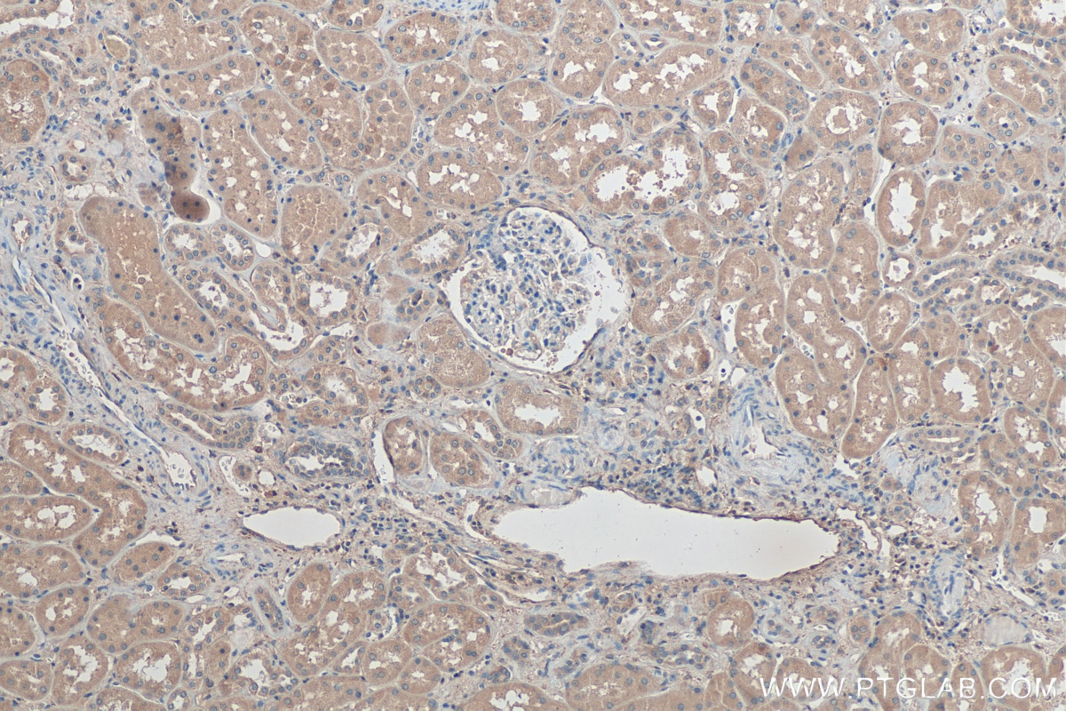 Immunohistochemistry (IHC) staining of human kidney tissue using YES1 Monoclonal antibody (67196-1-Ig)