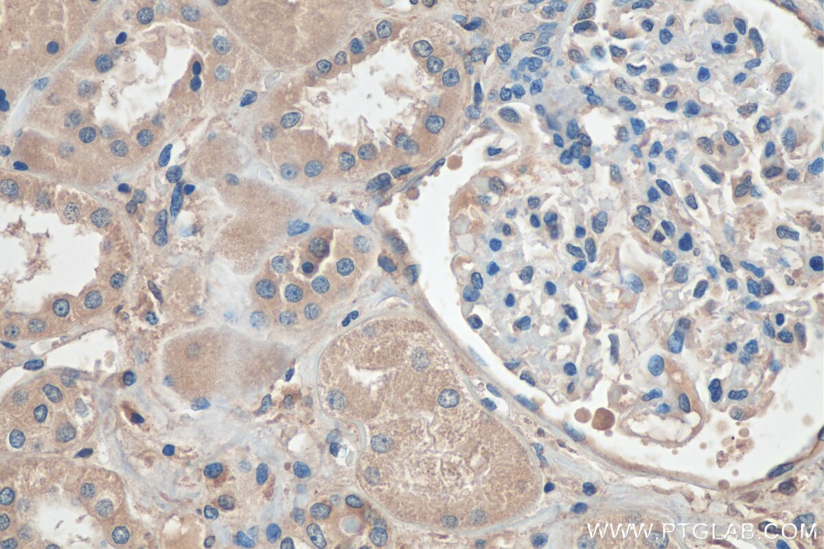 Immunohistochemistry (IHC) staining of human kidney tissue using YES1 Monoclonal antibody (67196-1-Ig)