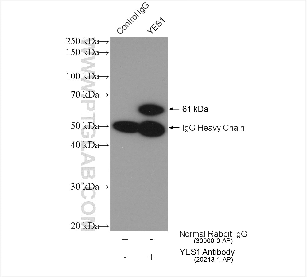 Immunoprecipitation (IP) experiment of A549 cells using YES1-Specific Polyclonal antibody (20243-1-AP)