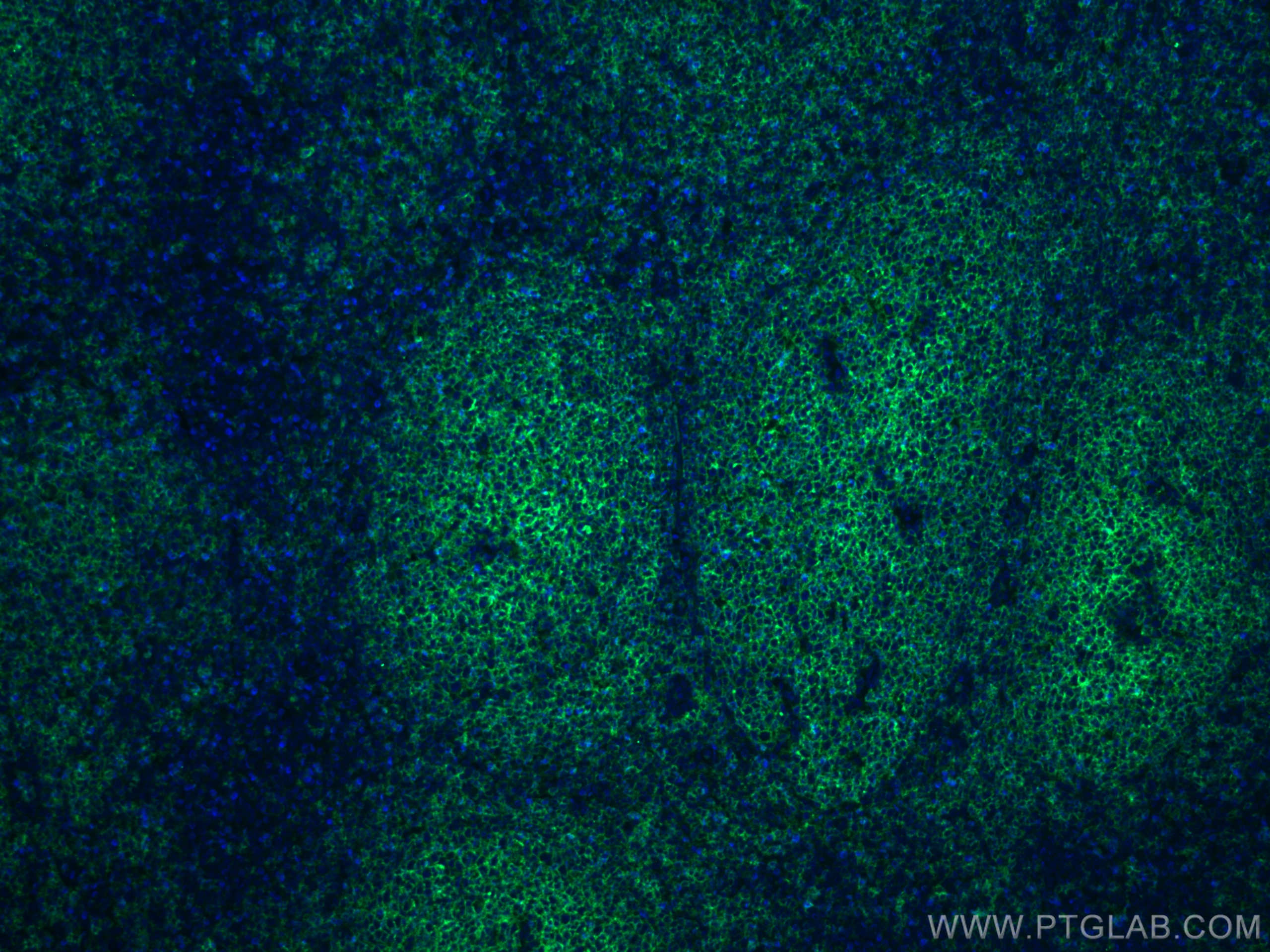 Immunofluorescence (IF) / fluorescent staining of human tonsillitis tissue using CoraLite® Plus 488-conjugated CD20 Monoclonal anti (CL488-60271)