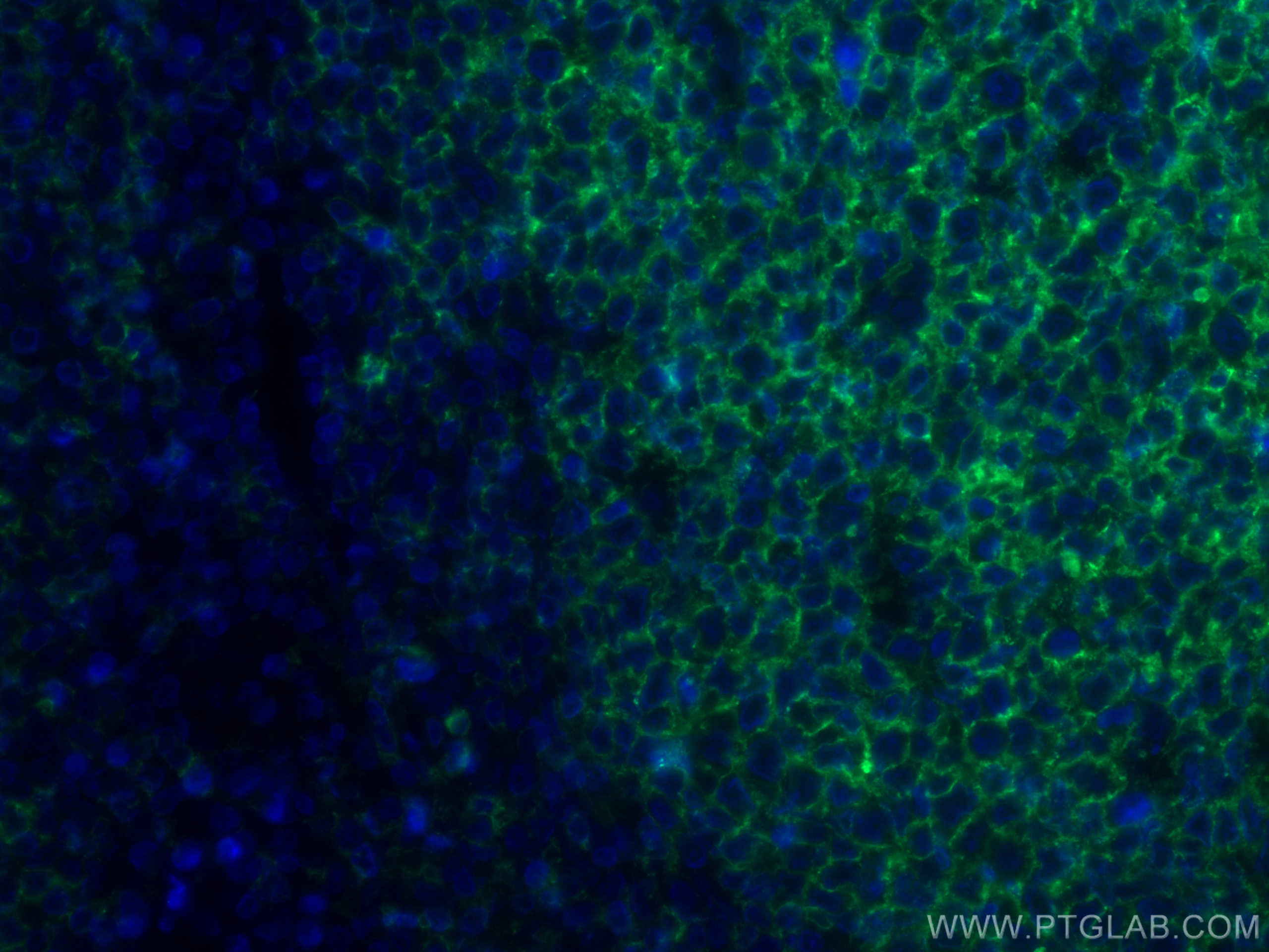 Immunofluorescence (IF) / fluorescent staining of human tonsillitis tissue using CoraLite® Plus 488-conjugated CD20 Monoclonal anti (CL488-60271)