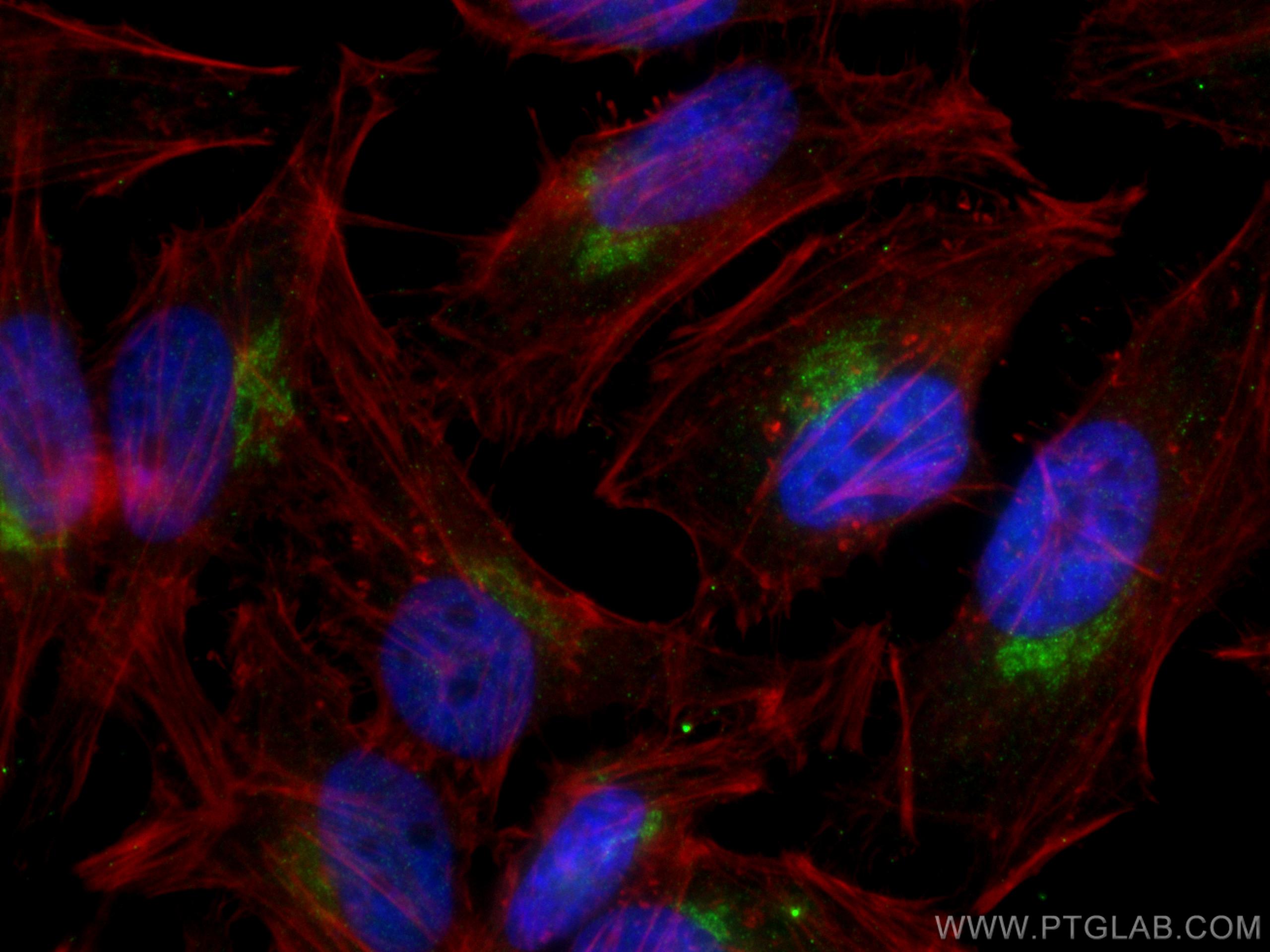 Immunofluorescence (IF) / fluorescent staining of HeLa cells using YIPF4 Polyclonal antibody (15473-1-AP)
