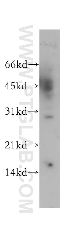 YIPF5