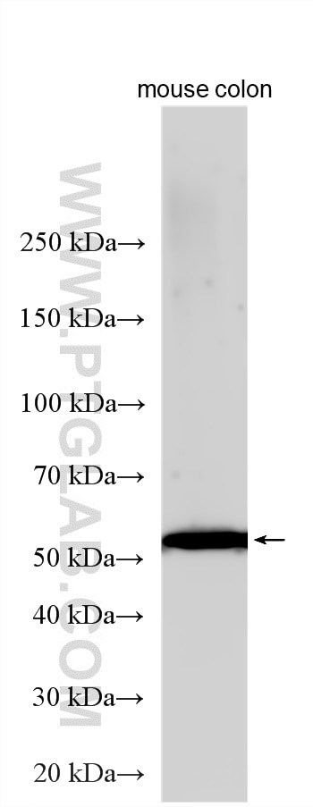Western Blot (WB) analysis of various lysates using YIPF6 Polyclonal antibody (30243-1-AP)