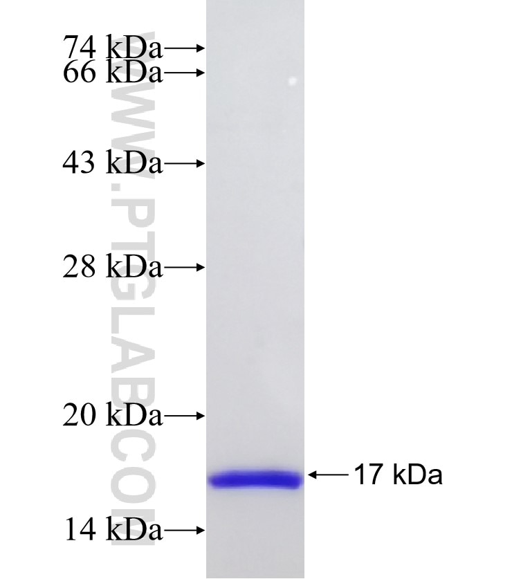 YIPF6 fusion protein Ag32477 SDS-PAGE YIPF6 fusion protein Ag32477 SDS-PAGE