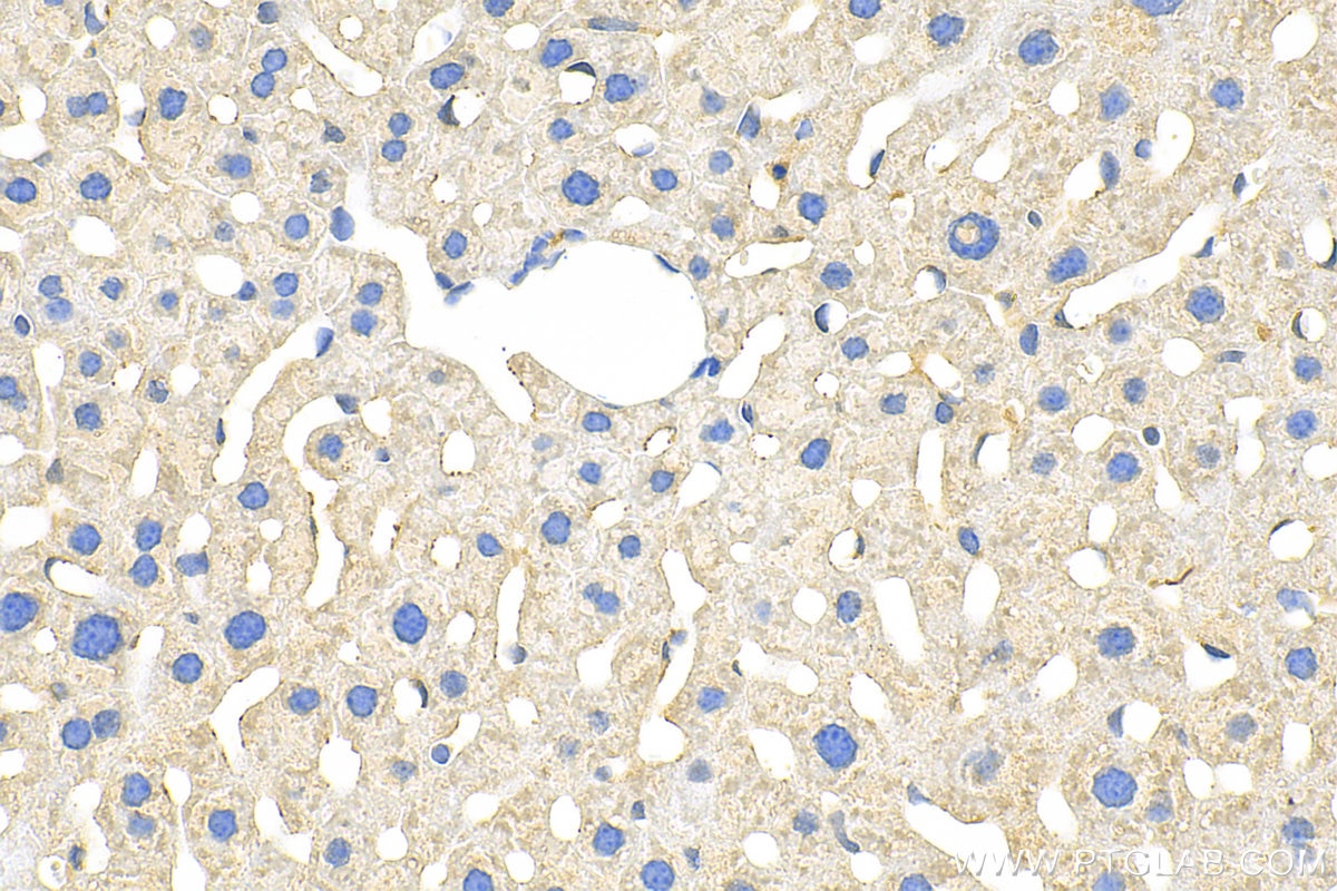 Immunohistochemistry (IHC) staining of mouse liver tissue using YIPF7 Polyclonal antibody (21347-1-AP)