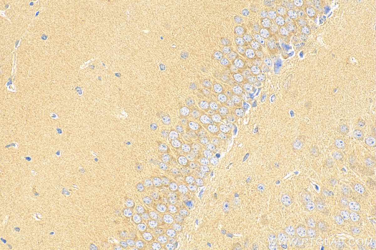 Immunohistochemistry (IHC) staining of mouse brain tissue using YIPF7 Polyclonal antibody (21347-1-AP)
