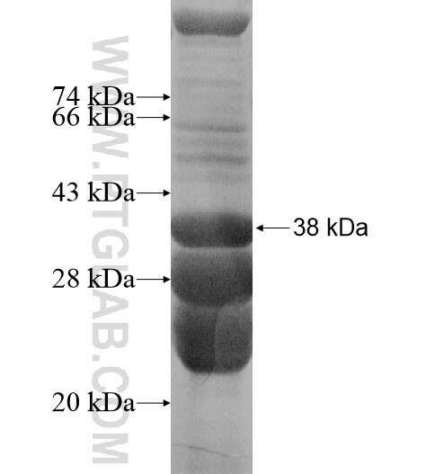 YIPF7 fusion protein Ag15695 SDS-PAGE