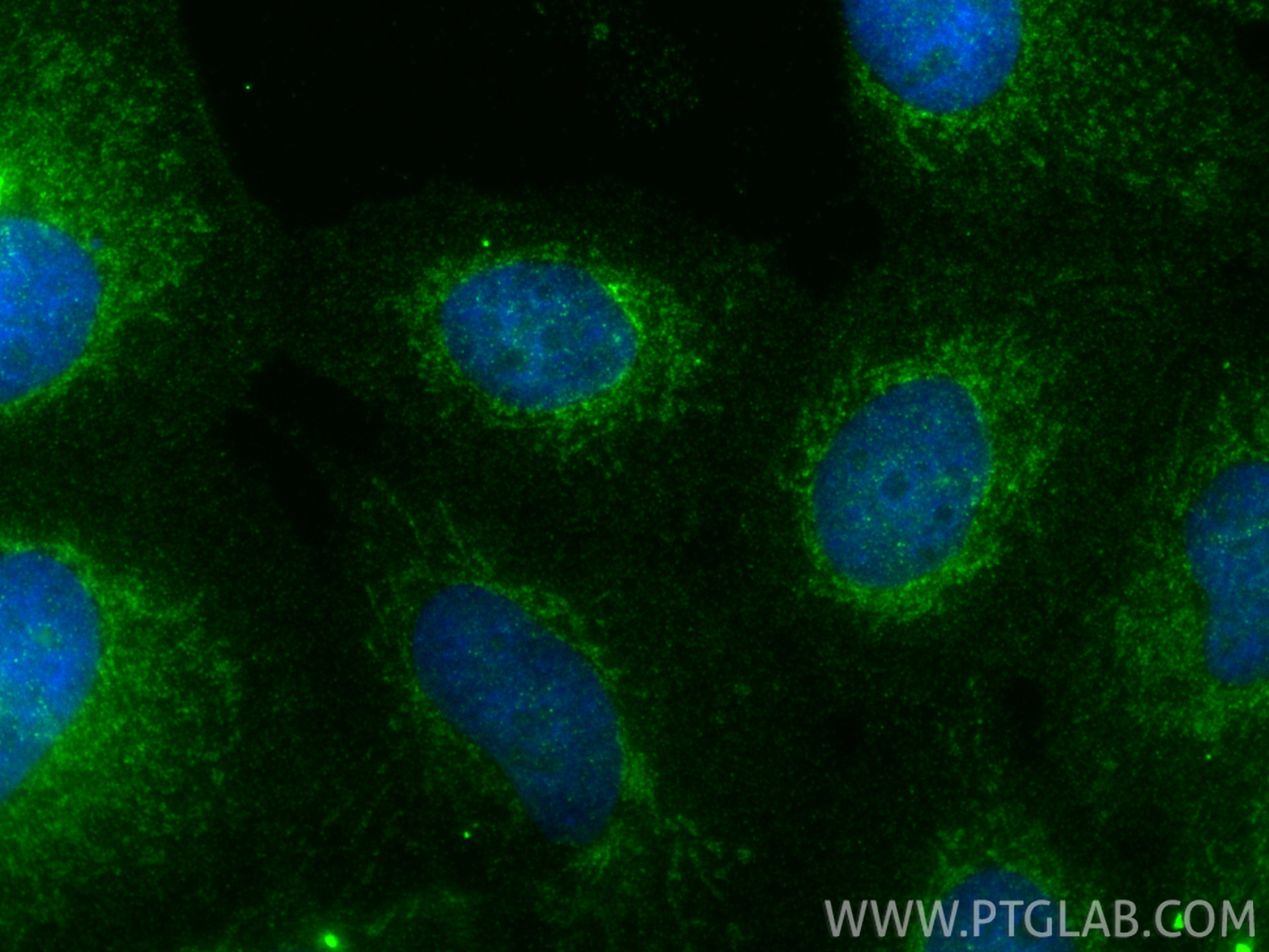 Immunofluorescence (IF) / fluorescent staining of A431 cells using YKT6 Polyclonal antibody (33685-1-AP)