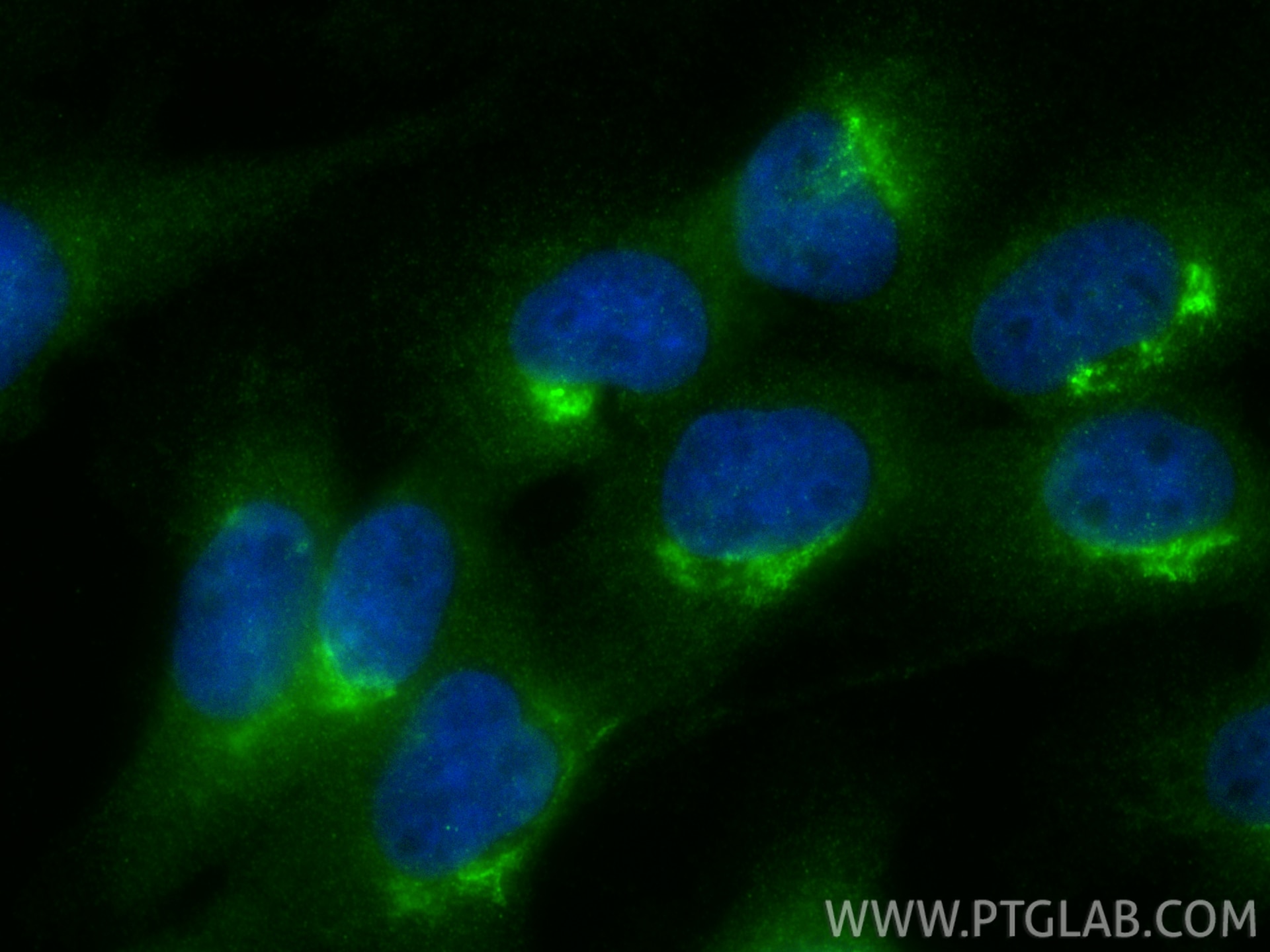 Immunofluorescence (IF) / fluorescent staining of U-251 cells using YKT6 Polyclonal antibody (33685-1-AP)
