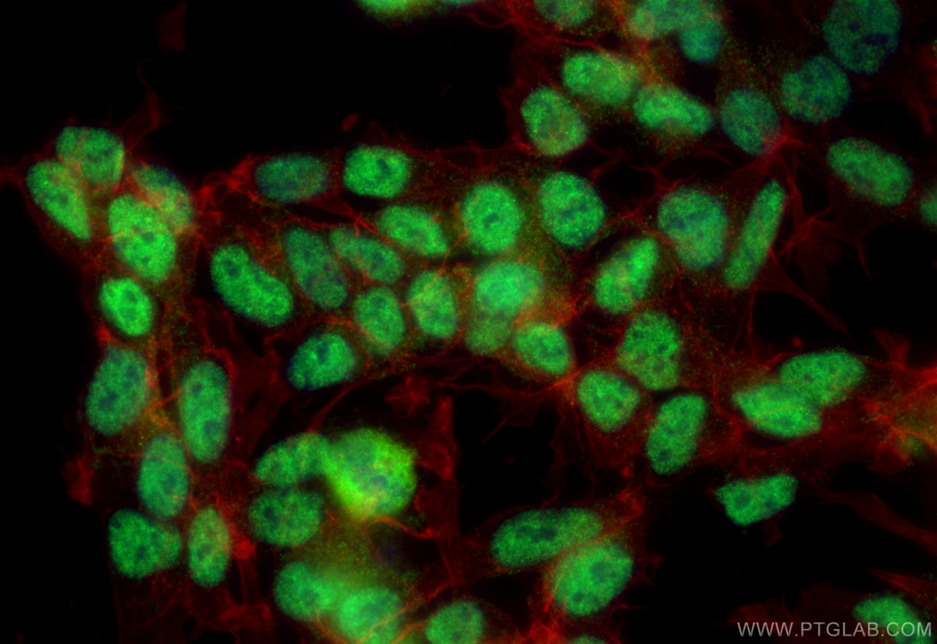 Immunofluorescence (IF) / fluorescent staining of SH-SY5Y cells using YLPM1 Polyclonal antibody (21332-1-AP)