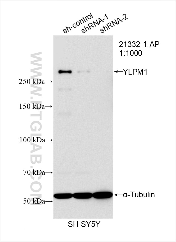 Western Blot (WB) analysis of SH-SY5Y cells using YLPM1 Polyclonal antibody (21332-1-AP)