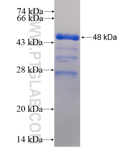YLPM1 fusion protein Ag15270 SDS-PAGE
