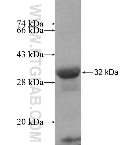 YLPM1 fusion protein Ag15408 SDS-PAGE YLPM1 fusion protein Ag15408 SDS-PAGE