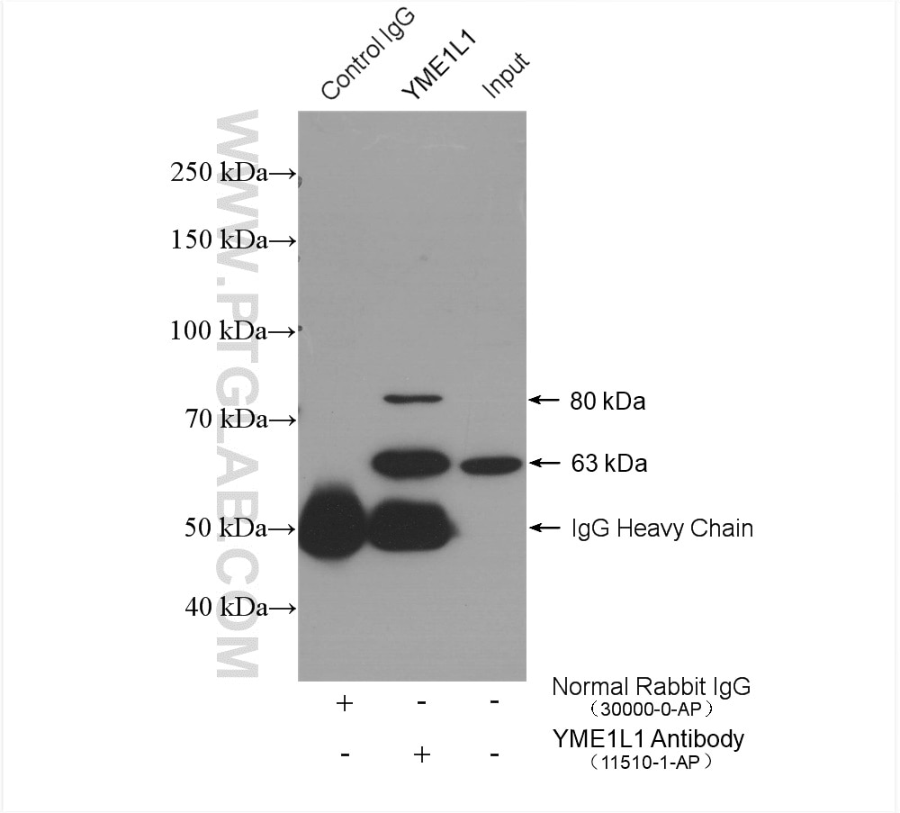 Immunoprecipitation (IP) experiment of HeLa cells using YME1L1 Polyclonal antibody (11510-1-AP)