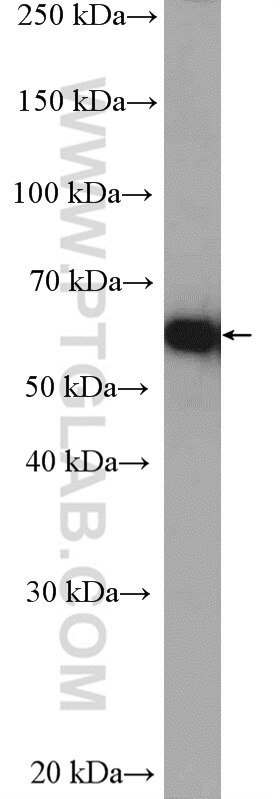 Western Blot (WB) analysis of HeLa cells using YME1L1 Polyclonal antibody (11510-1-AP)