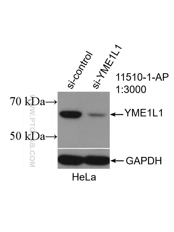 Western Blot (WB) analysis of HeLa cells using YME1L1 Polyclonal antibody (11510-1-AP)