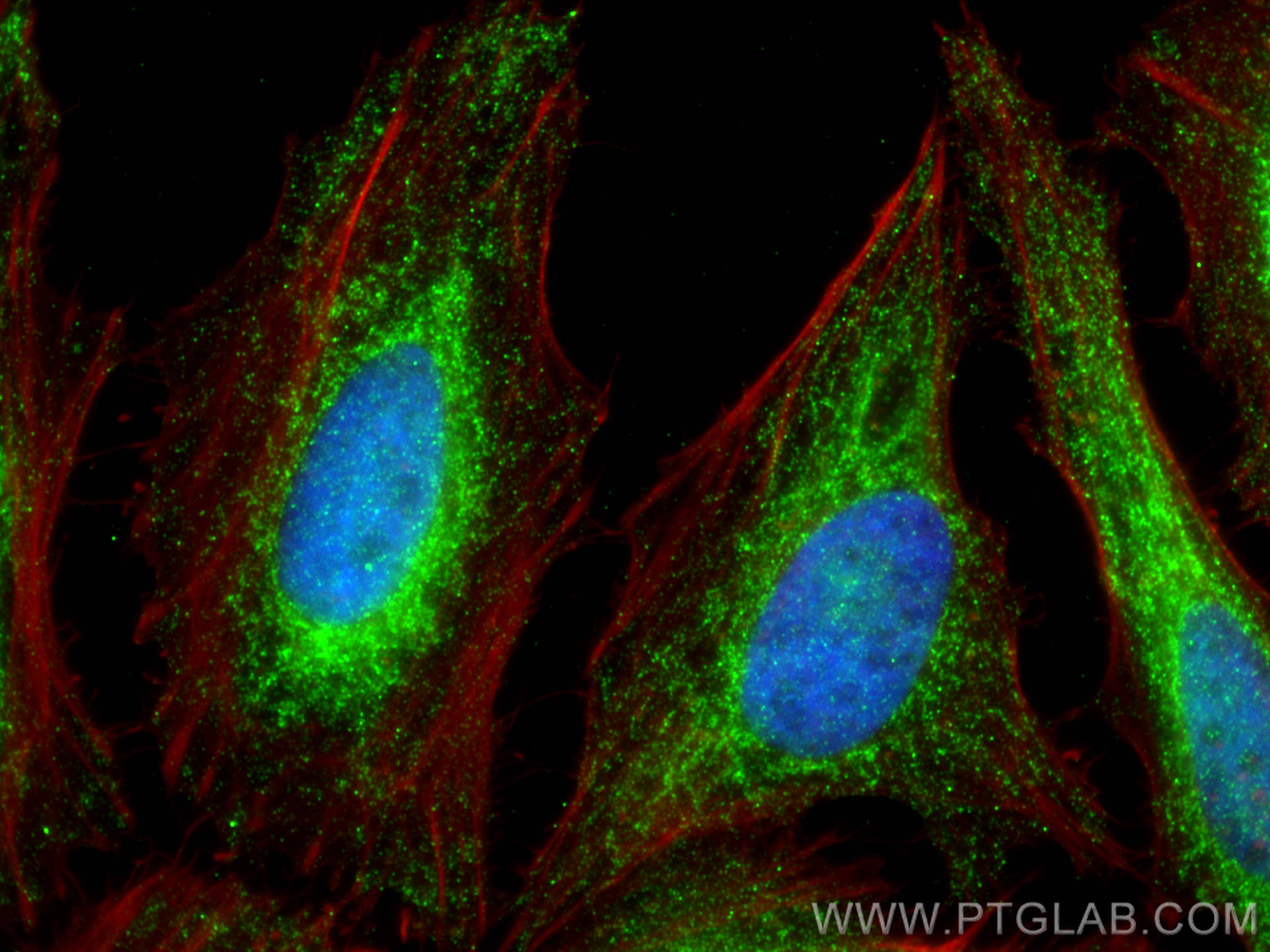 Immunofluorescence (IF) / fluorescent staining of HeLa cells using YME1L1 Polyclonal antibody (27856-1-AP)