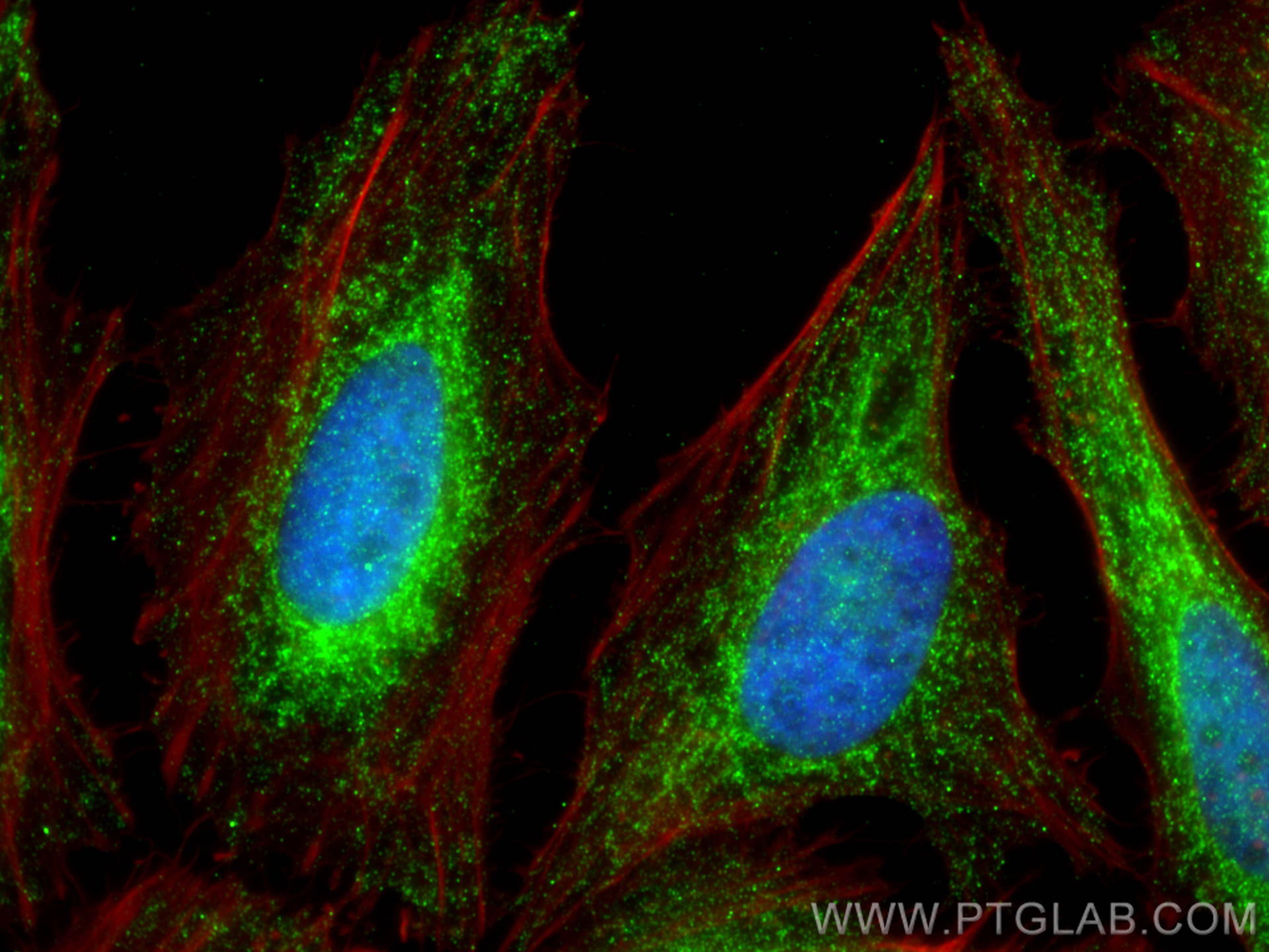 IF Staining of HeLa using 27856-1-AP