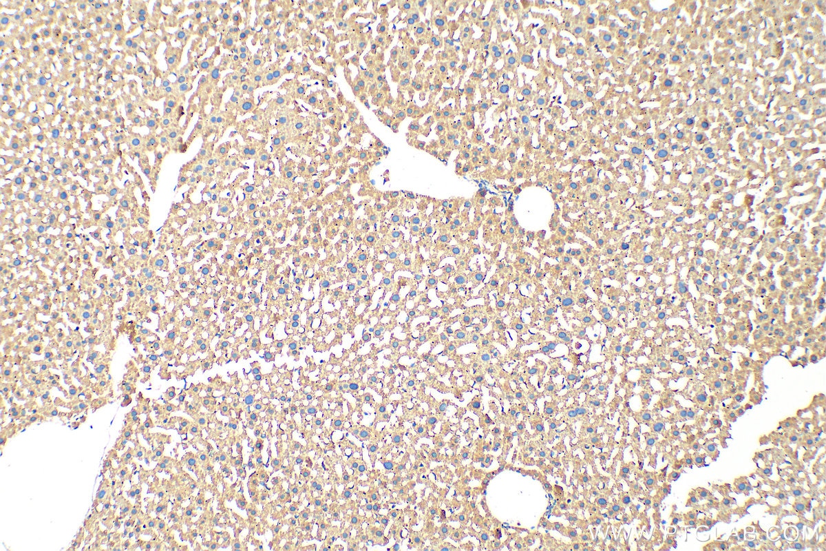 Immunohistochemistry (IHC) staining of mouse liver tissue using YME1L1 Polyclonal antibody (27856-1-AP)