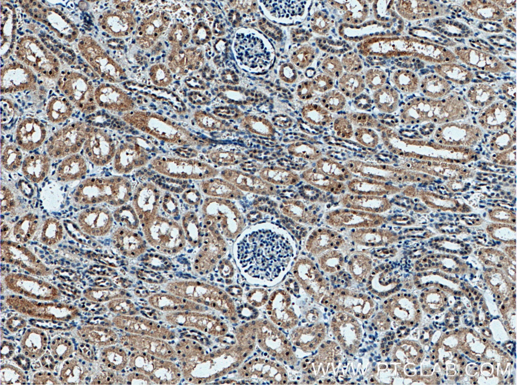 Immunohistochemistry (IHC) staining of human kidney tissue using YME1L1 Monoclonal antibody (66551-1-Ig)