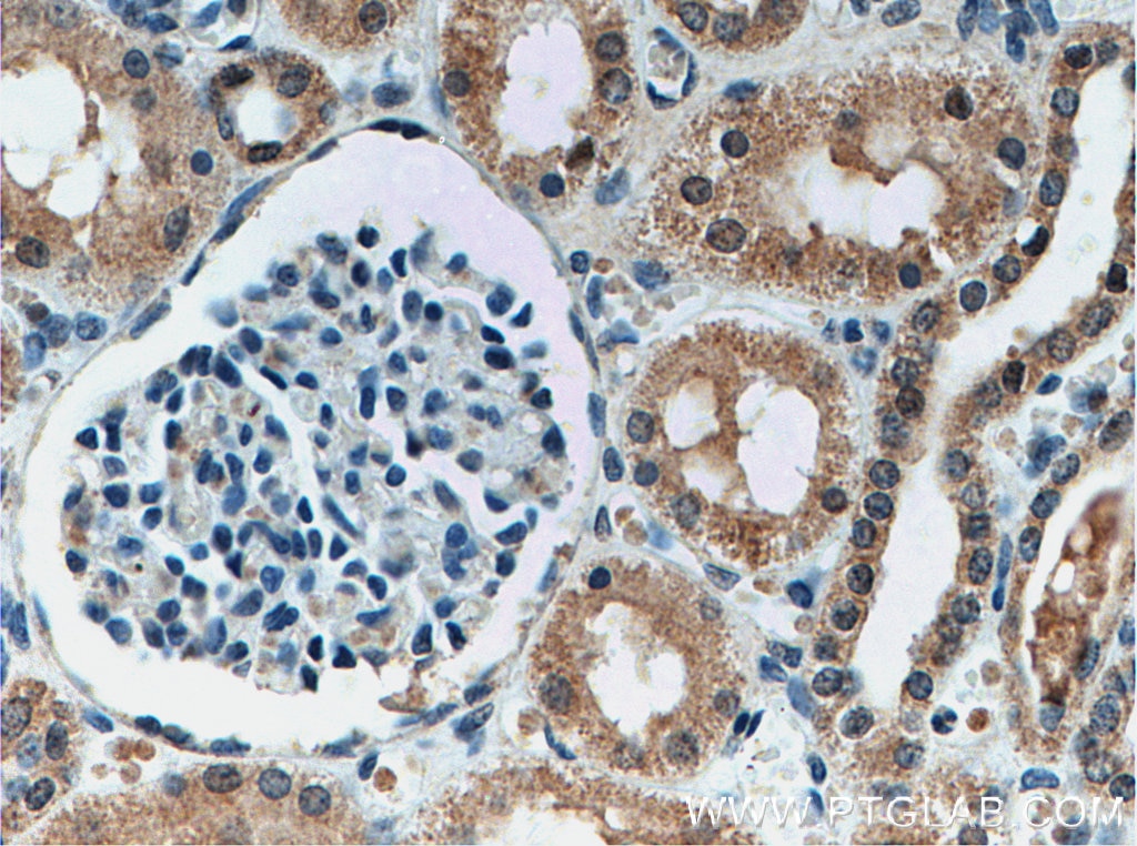 Immunohistochemistry (IHC) staining of human kidney tissue using YME1L1 Monoclonal antibody (66551-1-Ig)