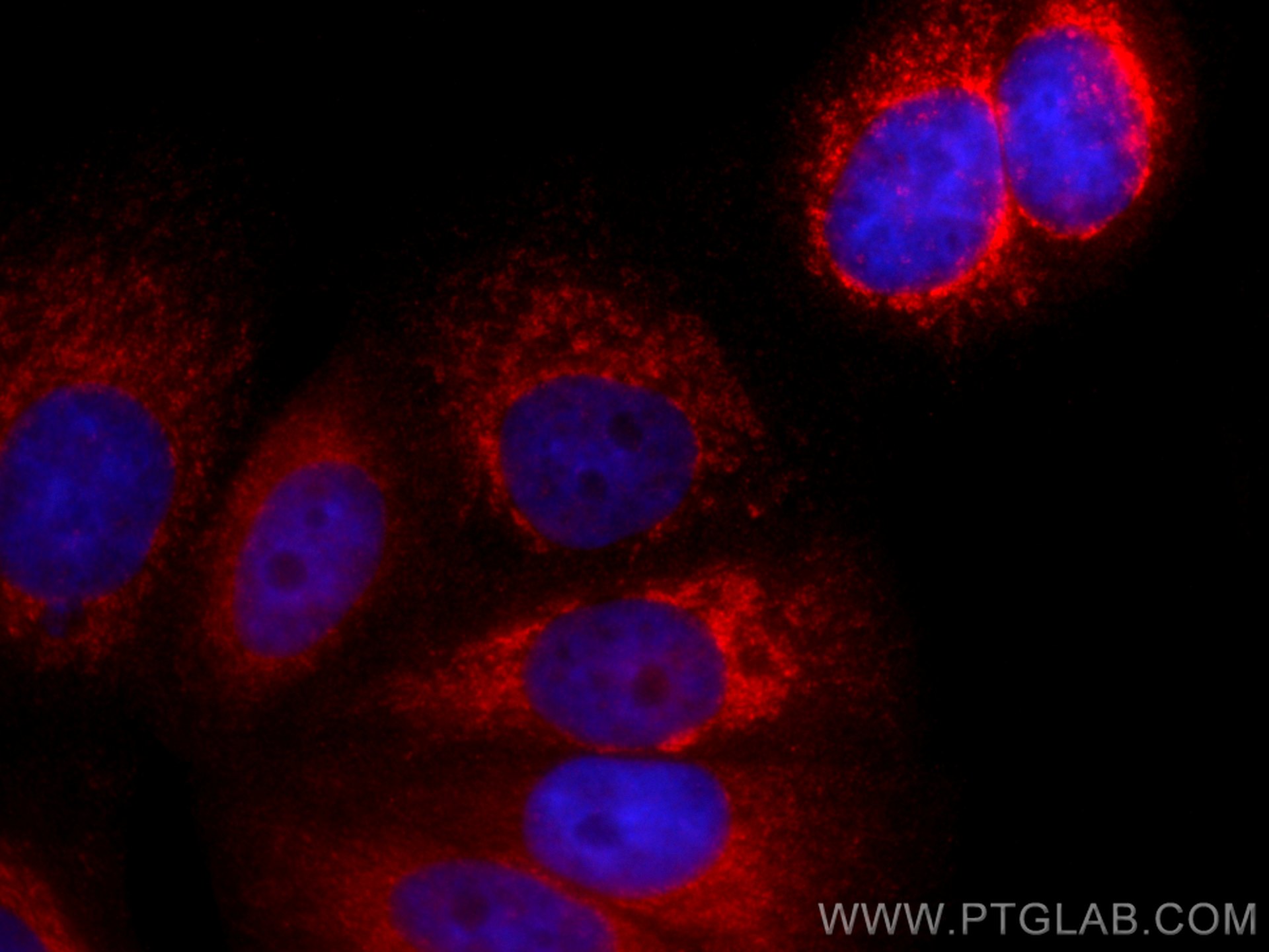 Immunofluorescence (IF) / fluorescent staining of MCF-7 cells using CoraLite®594-conjugated YME1L1 Polyclonal antibody (CL594-11510)