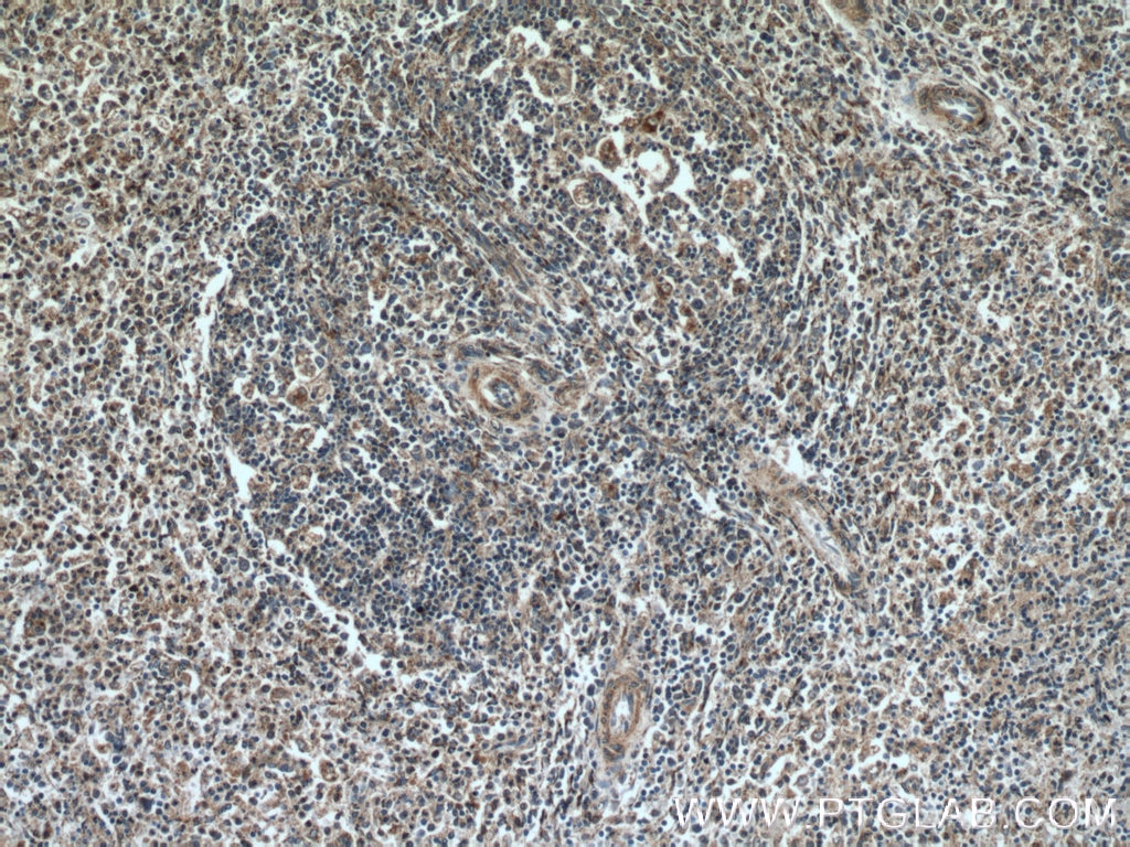 Immunohistochemistry (IHC) staining of human spleen tissue using YOD1 Polyclonal antibody (25370-1-AP)