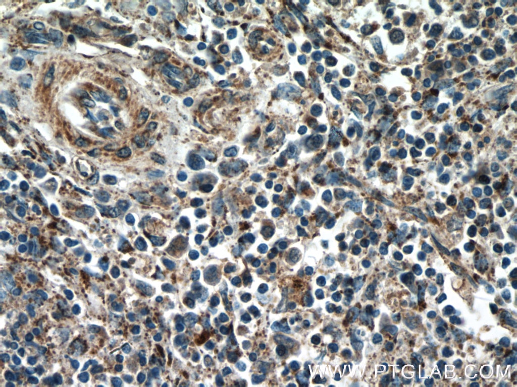 Immunohistochemistry (IHC) staining of human spleen tissue using YOD1 Polyclonal antibody (25370-1-AP)