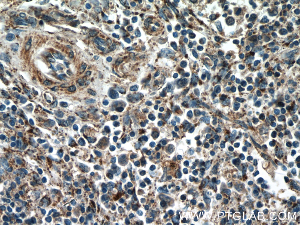 IHC staining of human spleen using 25370-1-AP