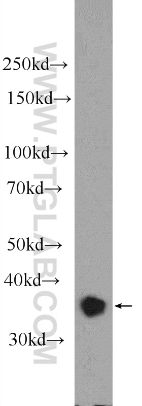 WB analysis of K-562 using 25370-1-AP