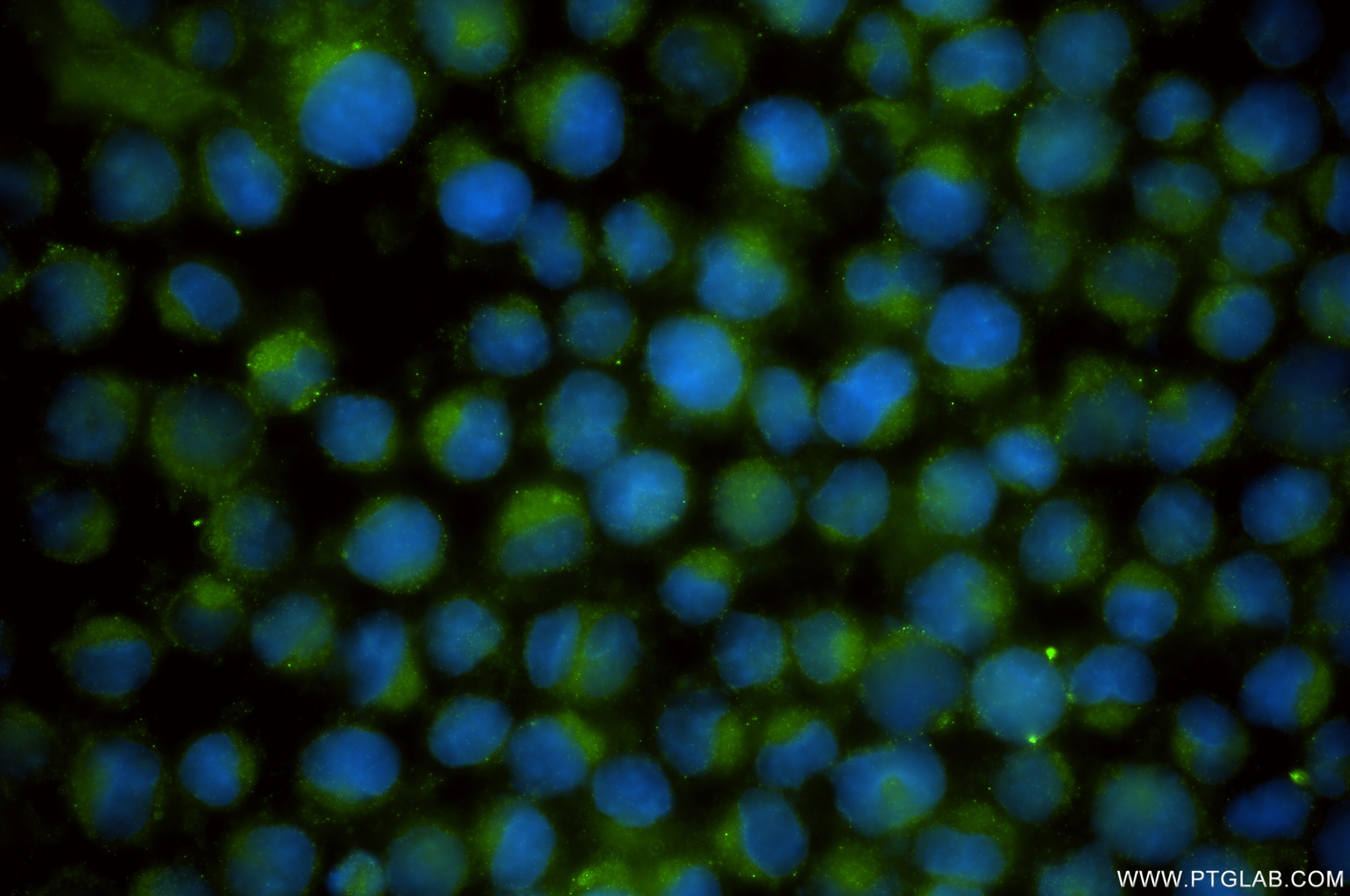 Immunofluorescence (IF) / fluorescent staining of K-562 cells using YOD1 Recombinant antibody (84933-5-RR)