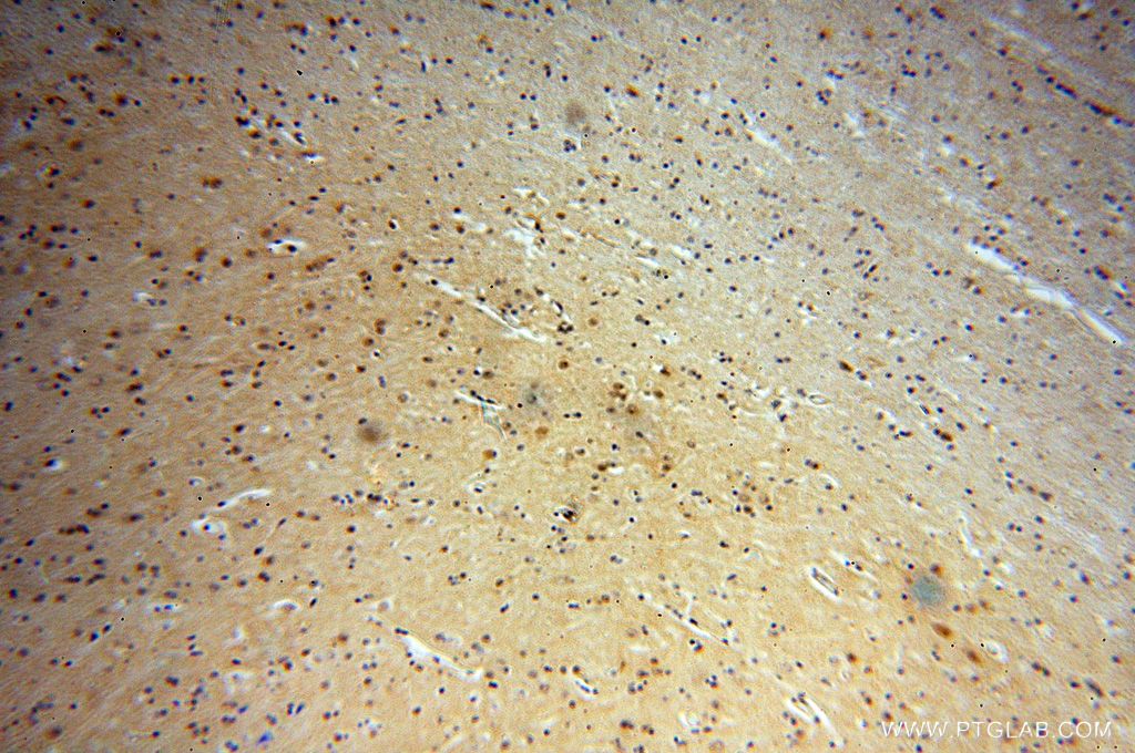 Immunohistochemistry (IHC) staining of human brain tissue using YPEL1 Polyclonal antibody (17743-1-AP)