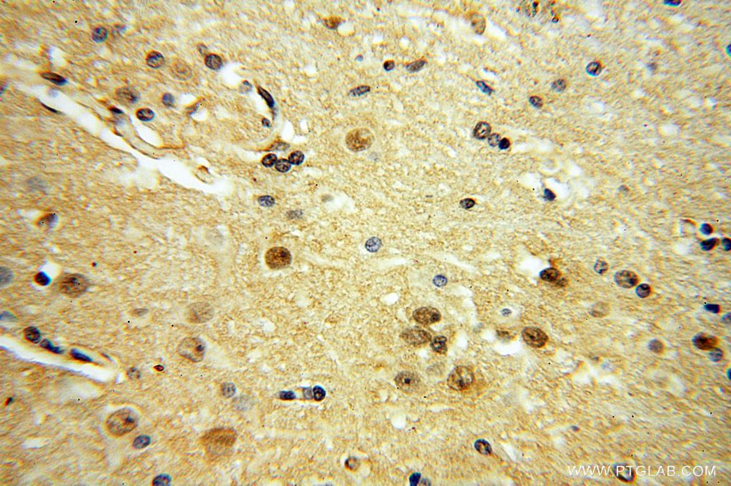 Immunohistochemistry (IHC) staining of human brain tissue using YPEL1 Polyclonal antibody (17743-1-AP)