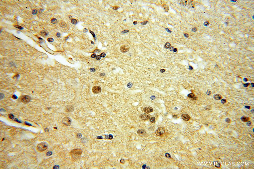 IHC staining of human brain using 17743-1-AP