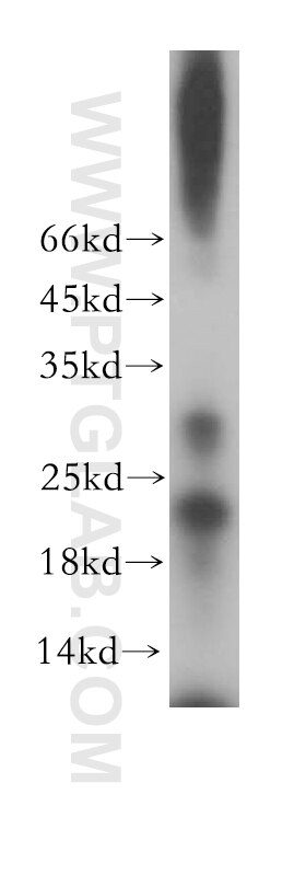 Western Blot (WB) analysis of human testis tissue using YPEL1 Polyclonal antibody (17743-1-AP)