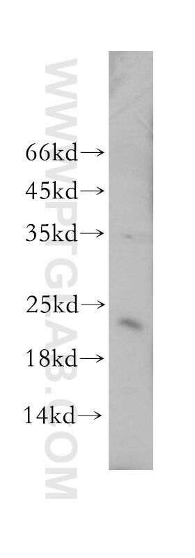 Western Blot (WB) analysis of human liver tissue using YPEL1 Polyclonal antibody (17743-1-AP)