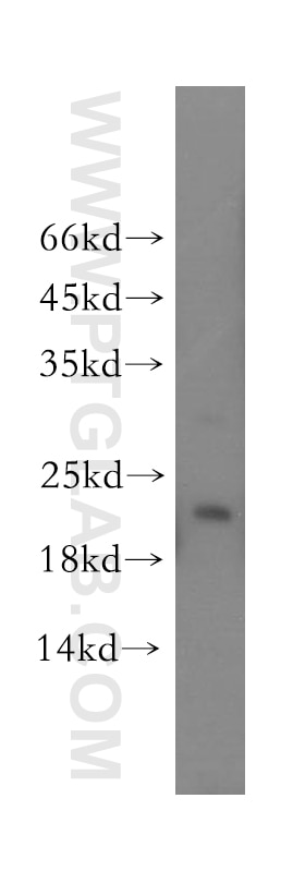 Western Blot (WB) analysis of human brain tissue using YPEL1 Polyclonal antibody (17743-1-AP)