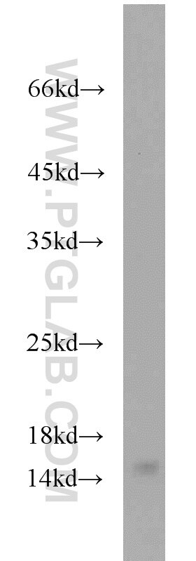 Western Blot (WB) analysis of mouse brain tissue using YPEL5 Polyclonal antibody (11730-1-AP)